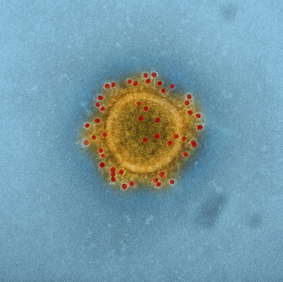 A microscopic look at a Coronavirus cell.